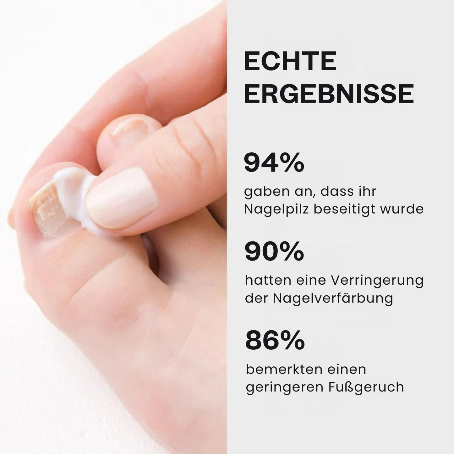 Behandlungsgel gegen Nagelpilz